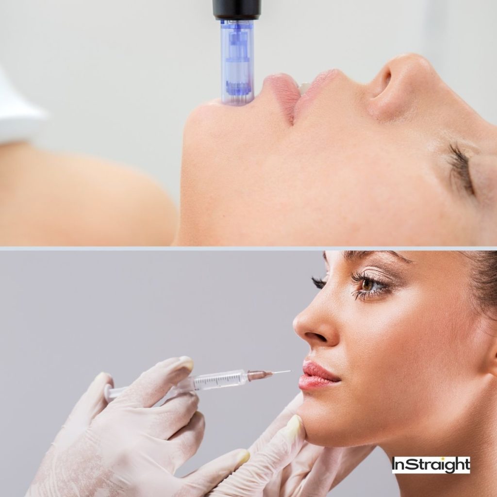 two ladies getting microneedling and botox